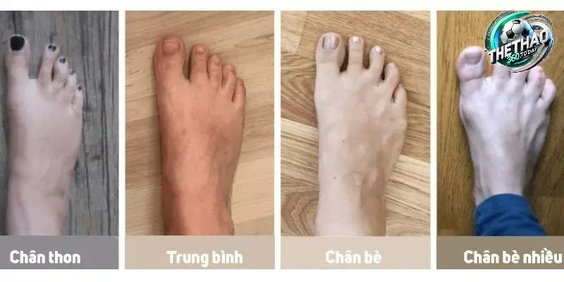 Bàn Chân Bình Thường (Neutral Arches)